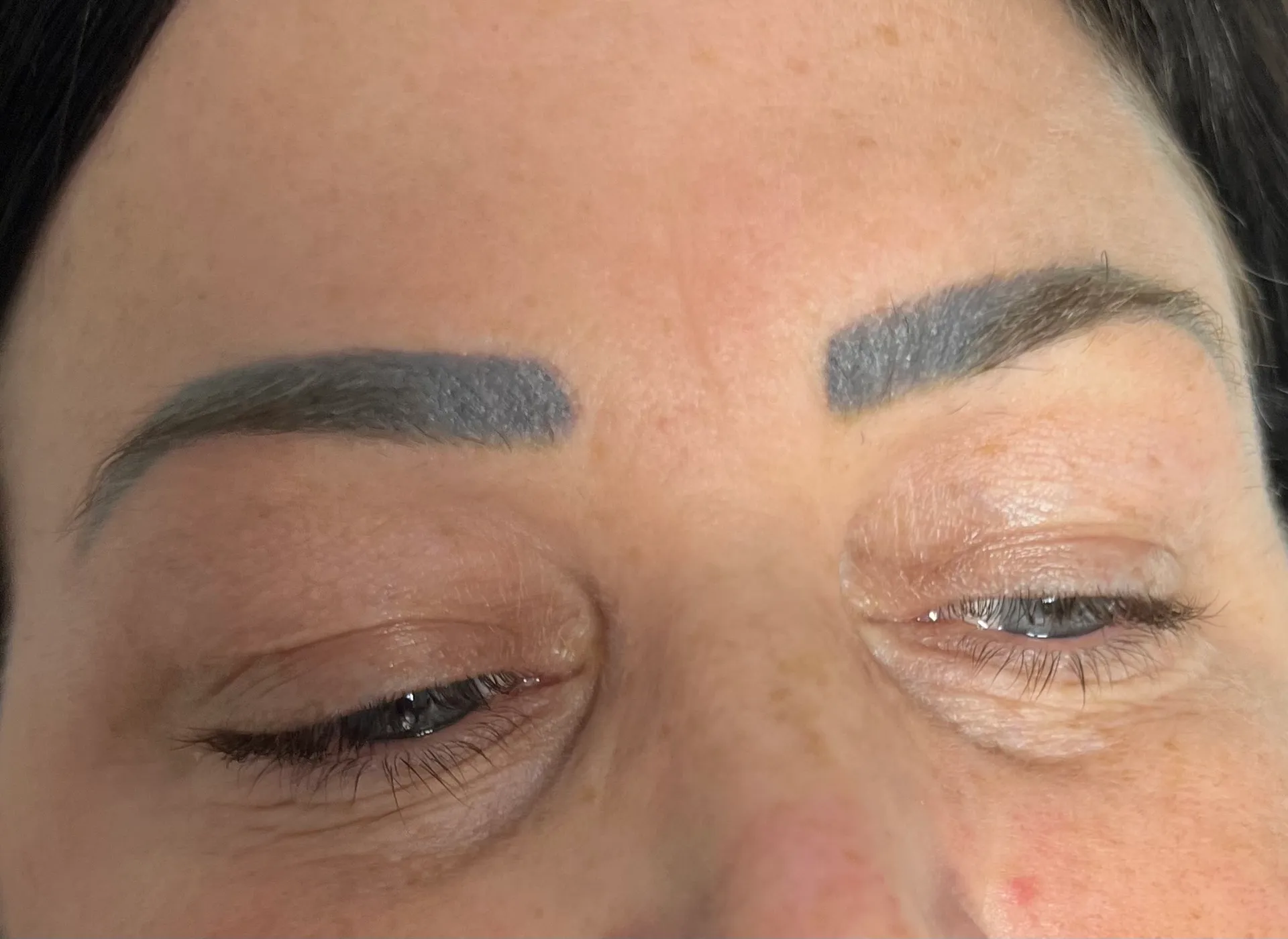 After - Before and after microblading tattoo removal treatment at Mode Laser Skin Clinic showing natural brow enhancement