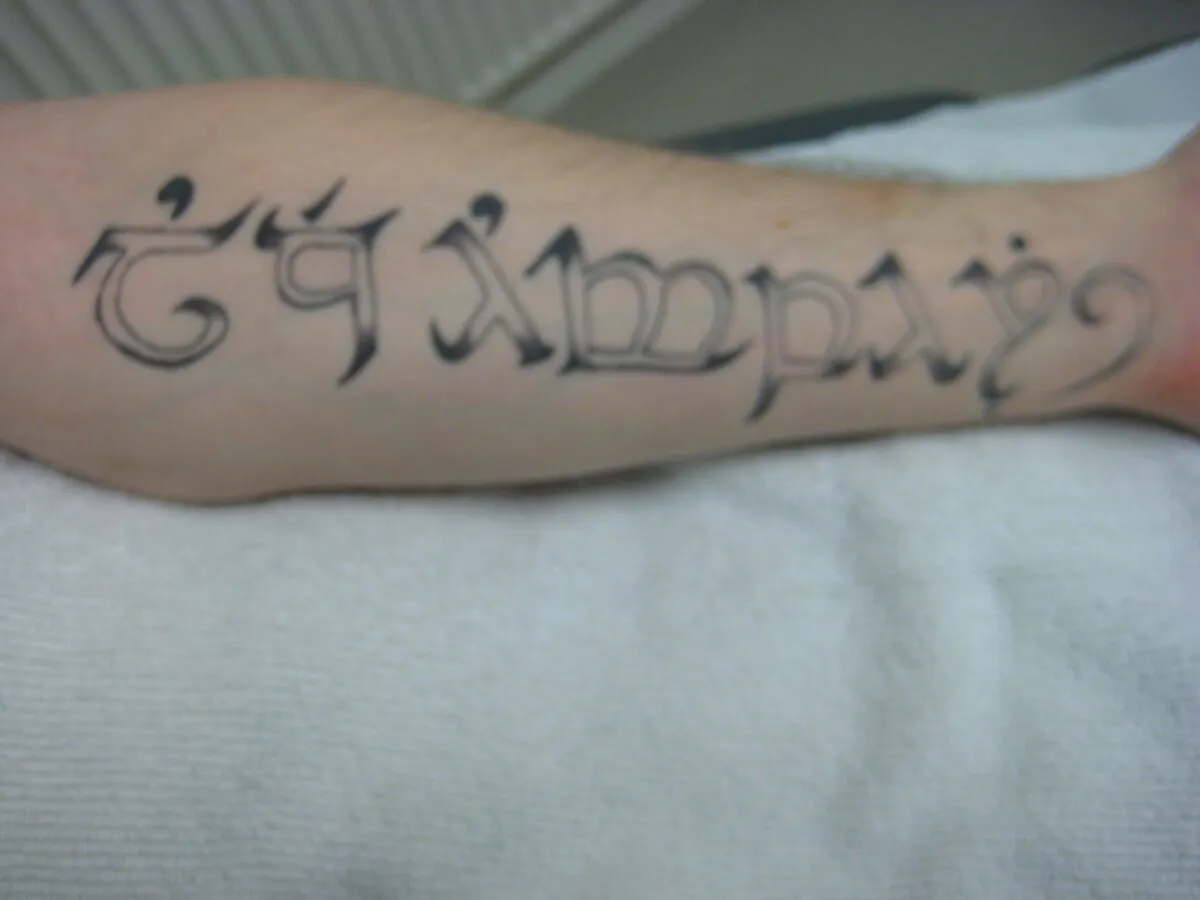 Tattoo before treatment