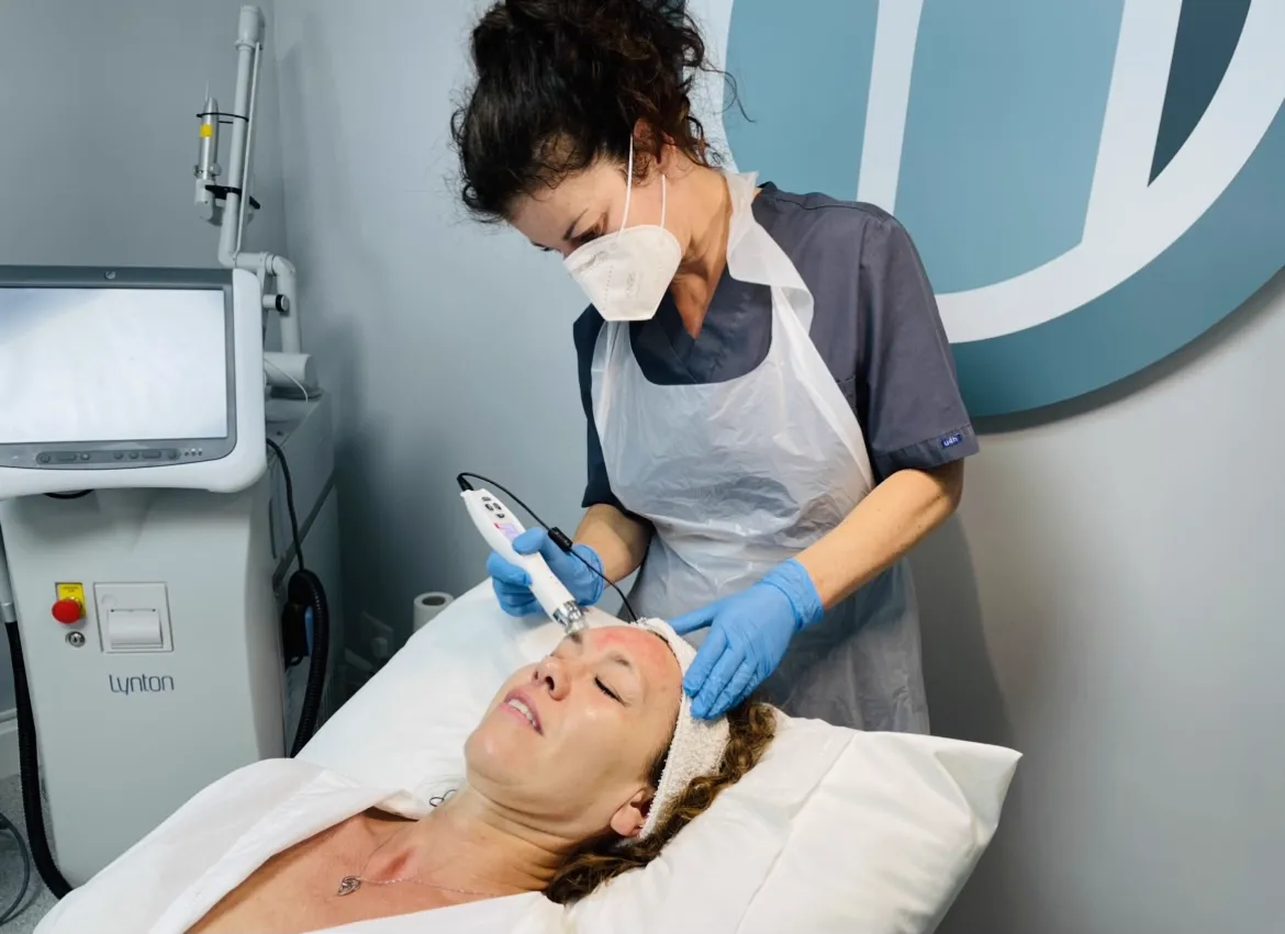 EPN microneedling treatment device for skin rejuvenation