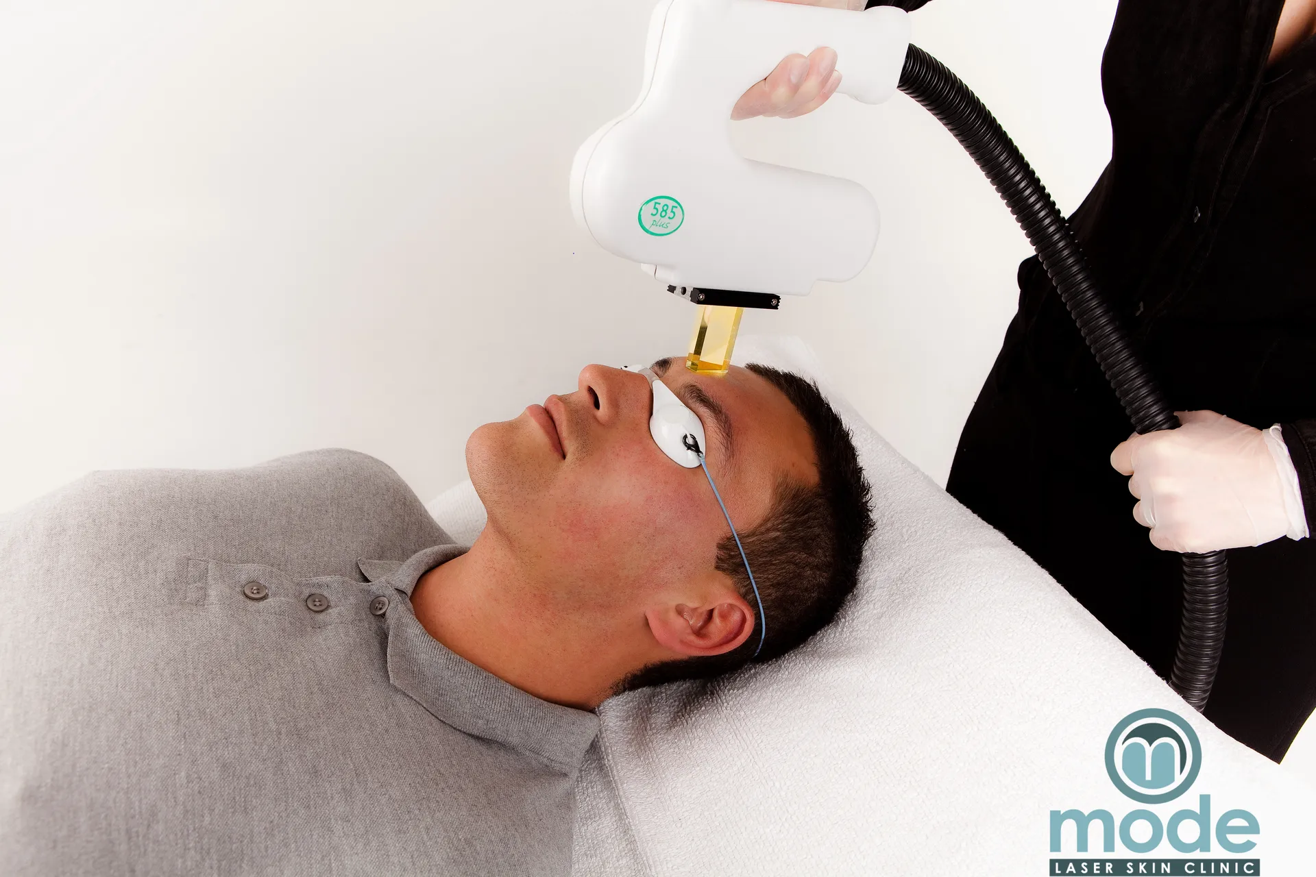 Laser skin treatment at Mode Laser Skin Clinic
